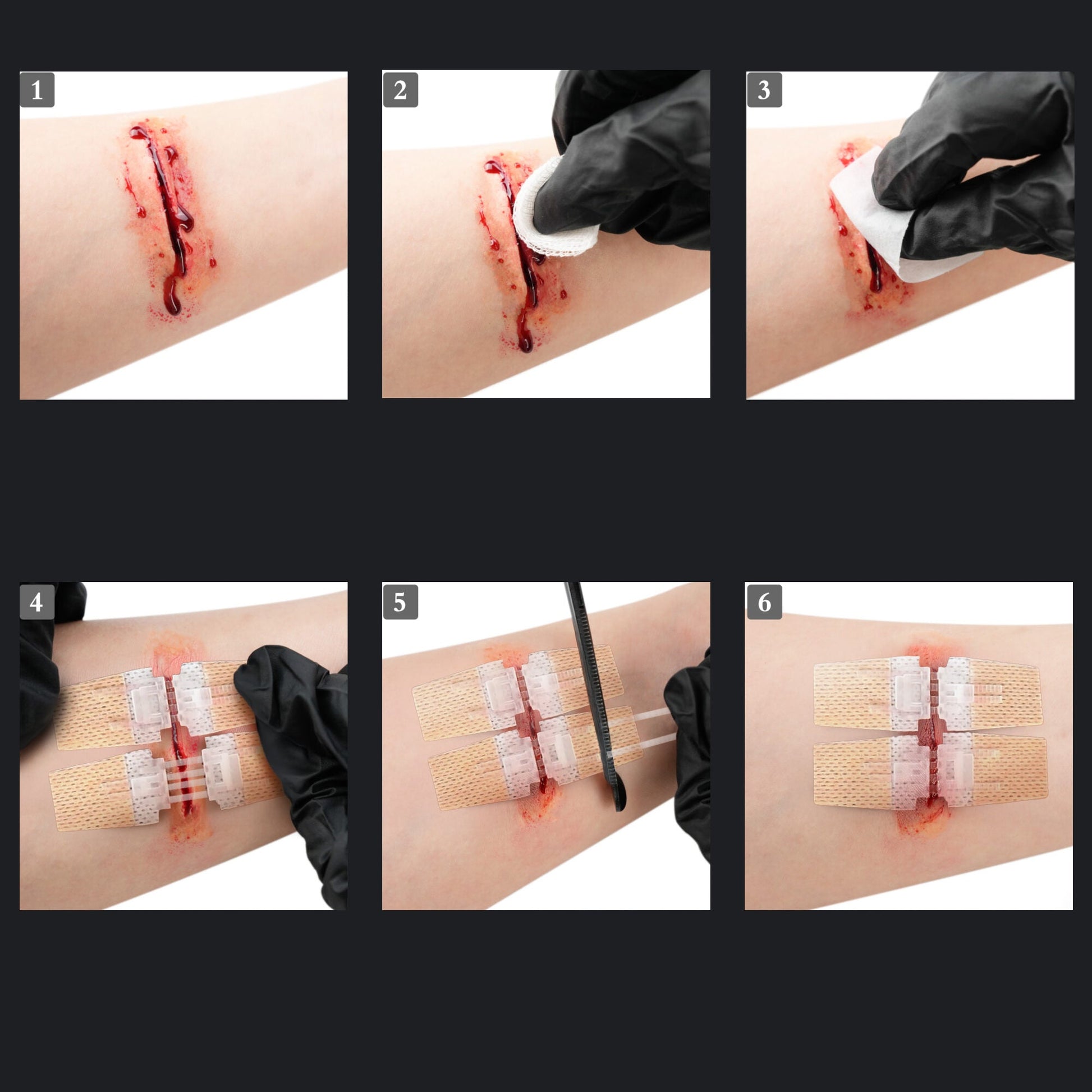 Advanced Wound Closure Kit: ZipClose Laceration (Stitch Free)