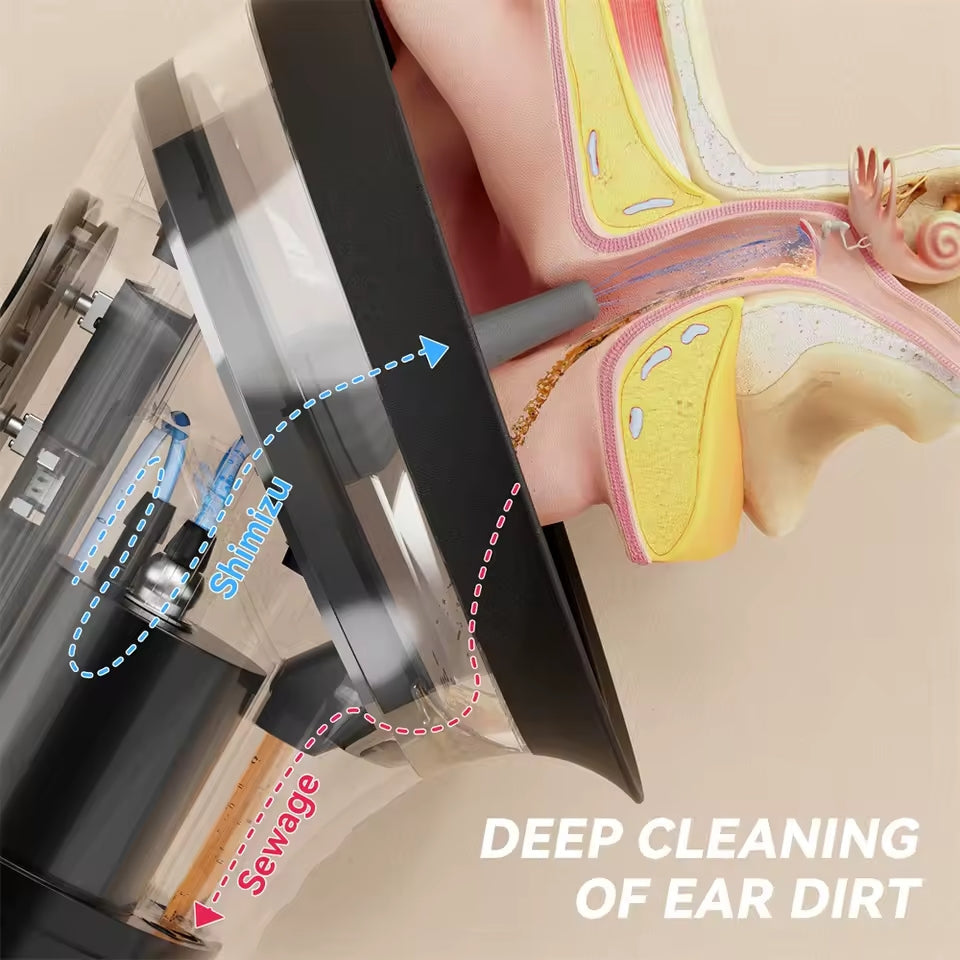 Electric Ear Wax Removal
