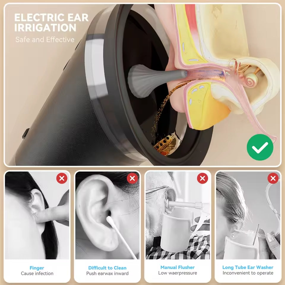 Electric Ear Wax Removal